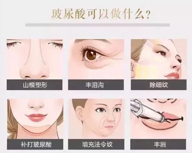 革新口腔美容領(lǐng)域，最新溶斑術(shù)引領(lǐng)新篇章
