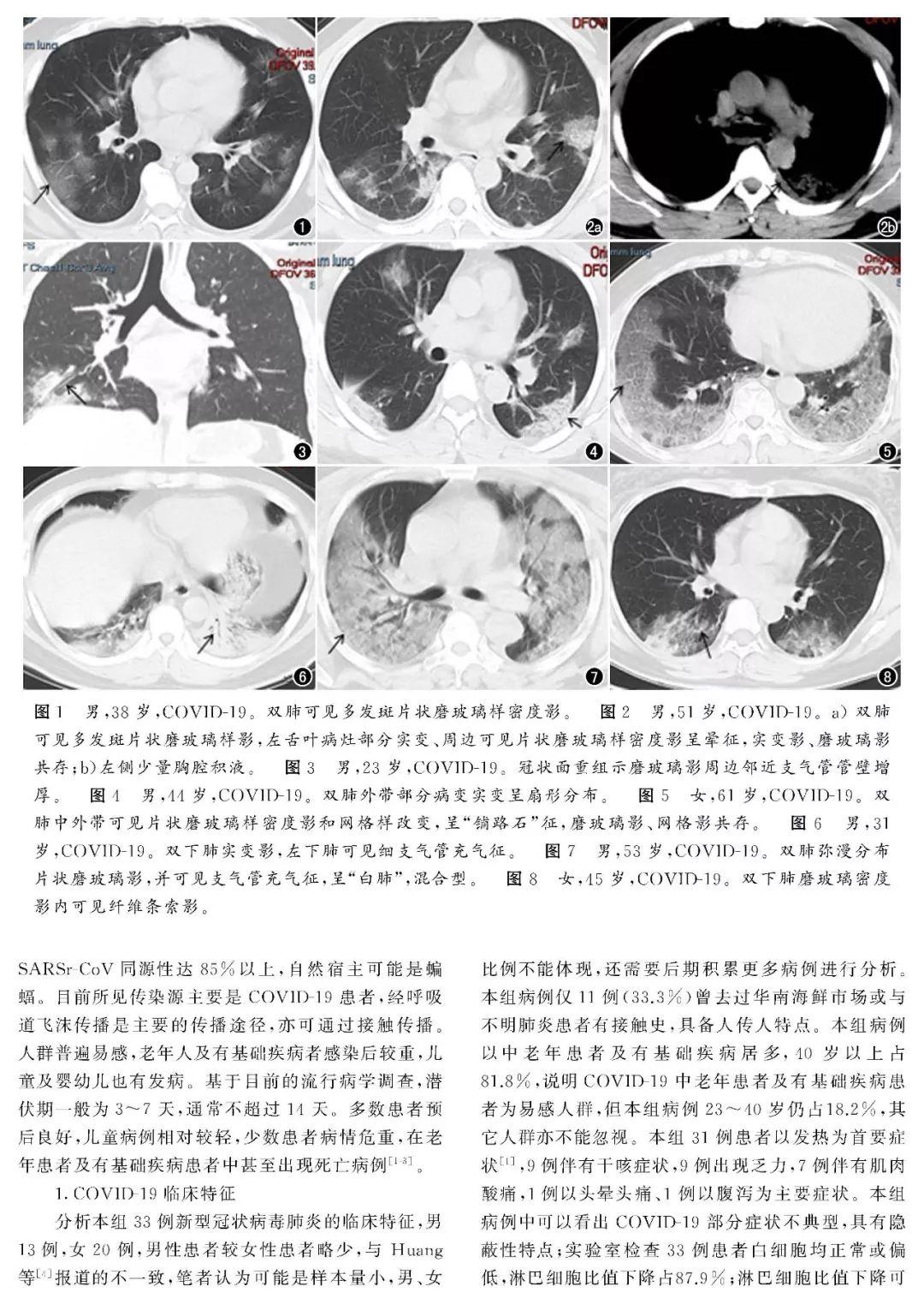 全球視野下的新貴肺炎最新動態與應對策略