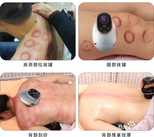 科技與傳統(tǒng)養(yǎng)生融合，最新電動(dòng)經(jīng)絡(luò)刷誕生！