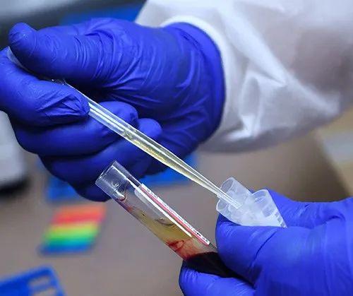 全球共同抗擊新冠疫情的挑戰與希望，最新抗疫文章綜述